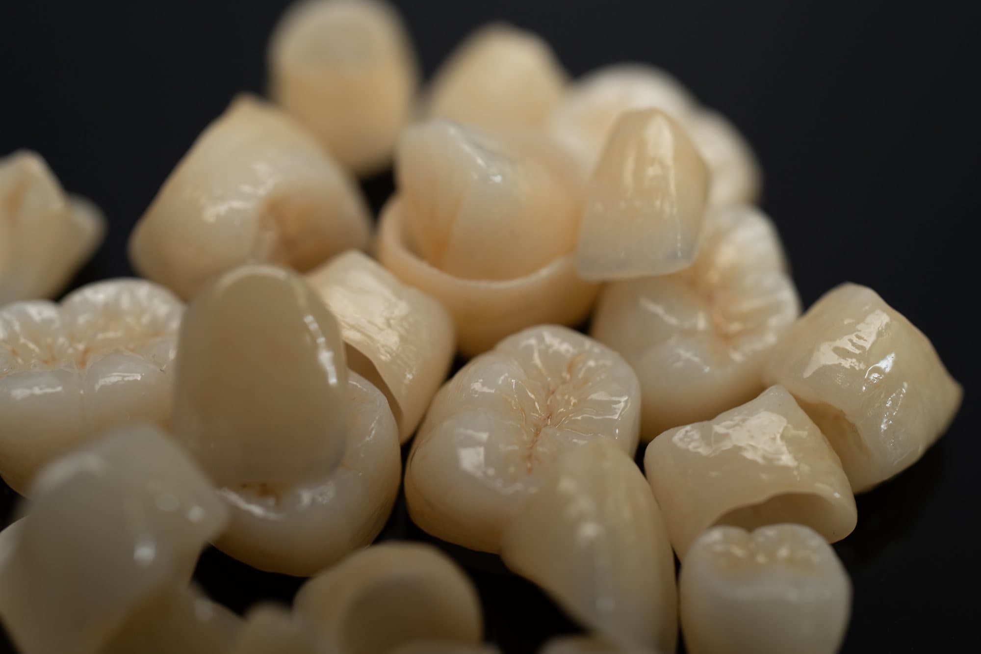 Frequently Asked Questions — DA'AT Dental Lab