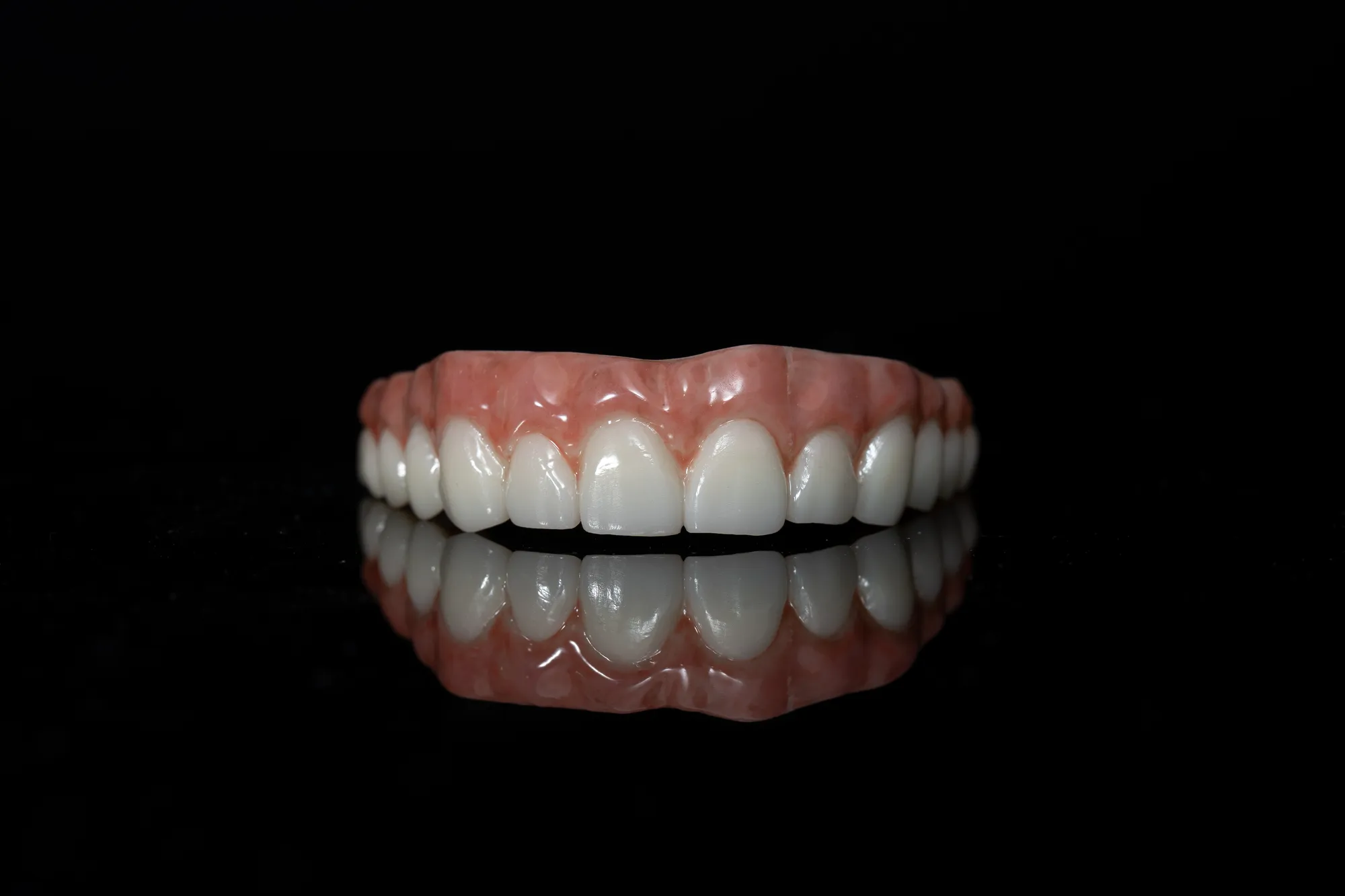 All-on-X — DA'AT Dental Lab