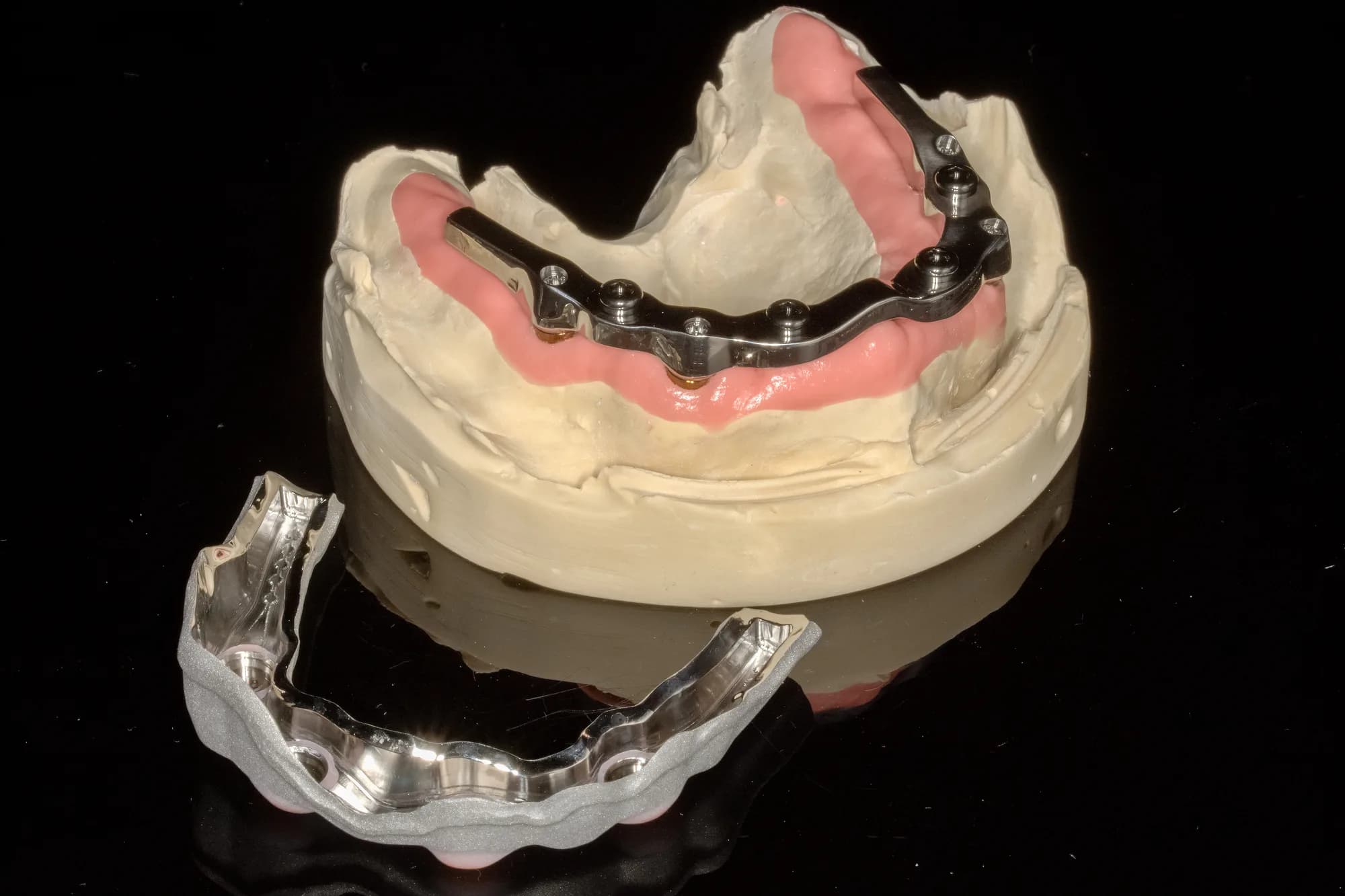 All-on-X case 3 — DA'AT Dental Lab