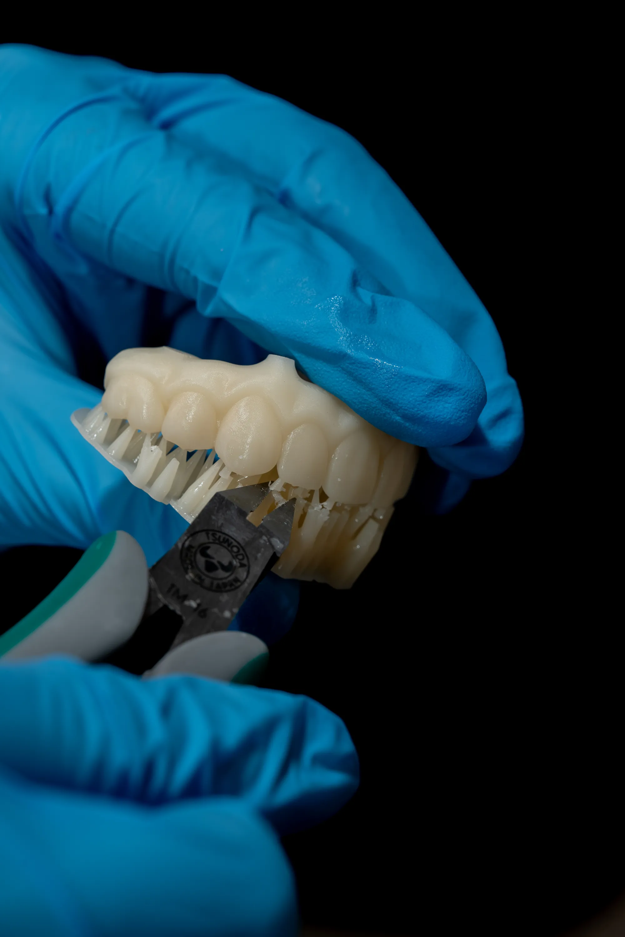 All-on-X case 4 — DA'AT Dental Lab