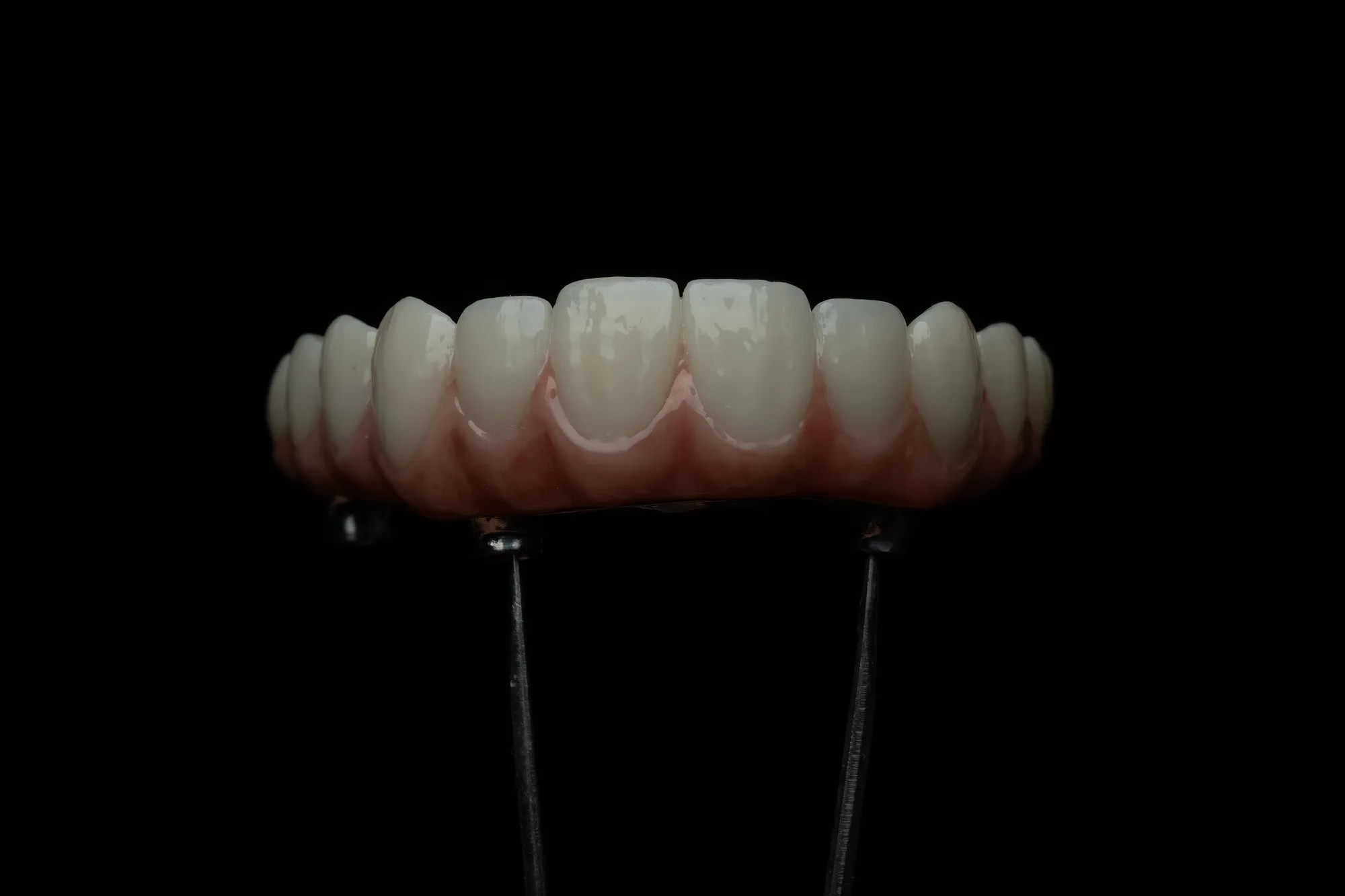 All-on-X — DA'AT Dental Lab