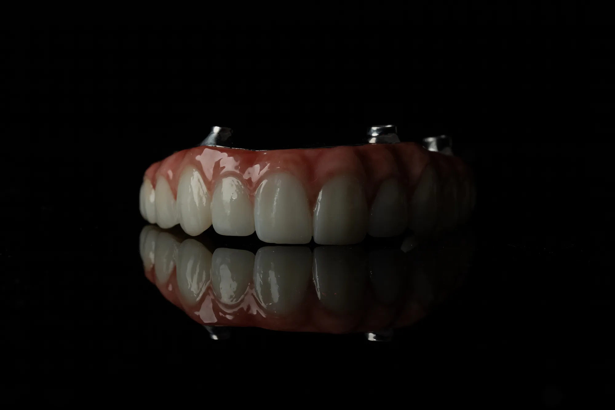 All-on-X case 1 — DA'AT Dental Lab