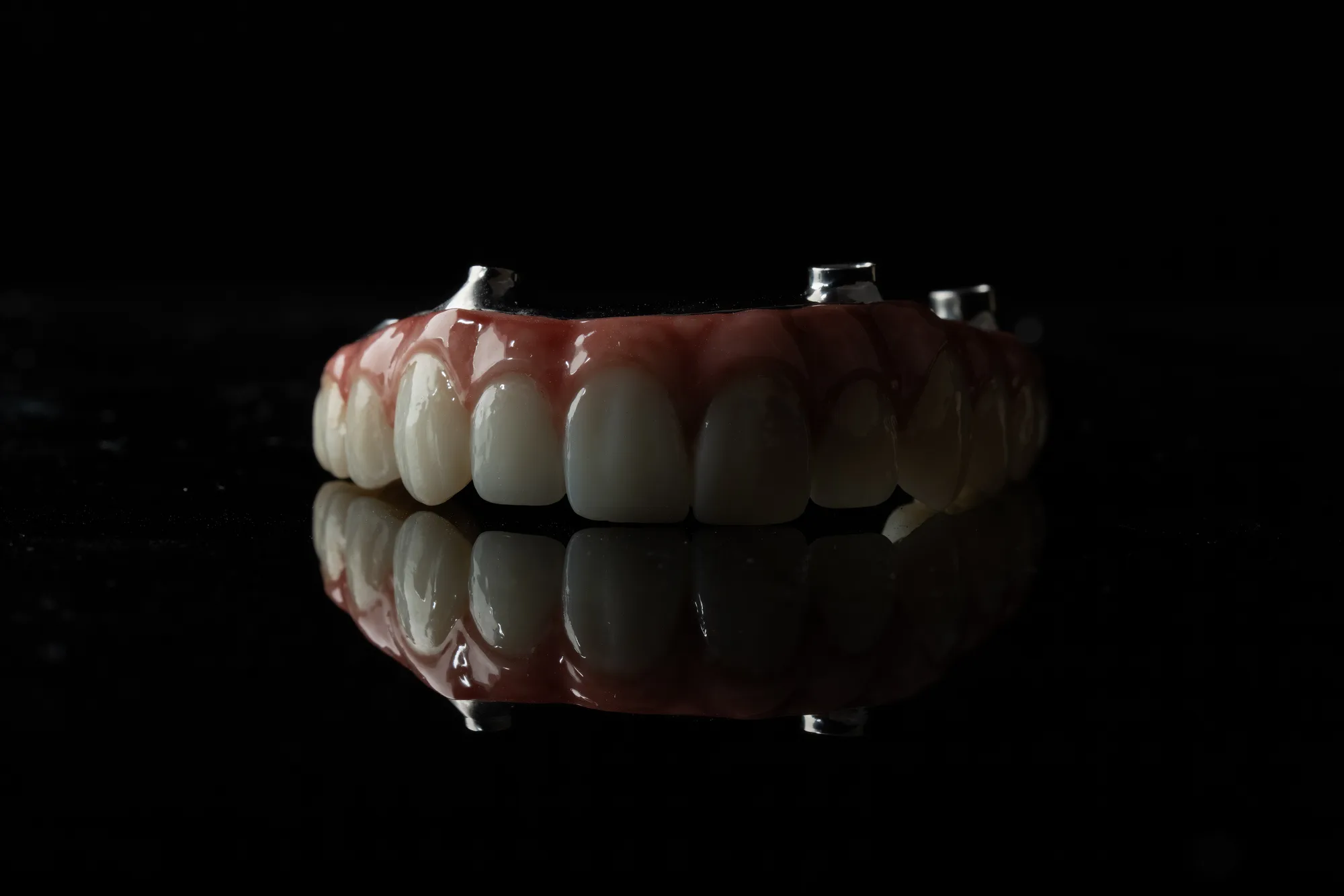 All-on-X case 2 — DA'AT Dental Lab