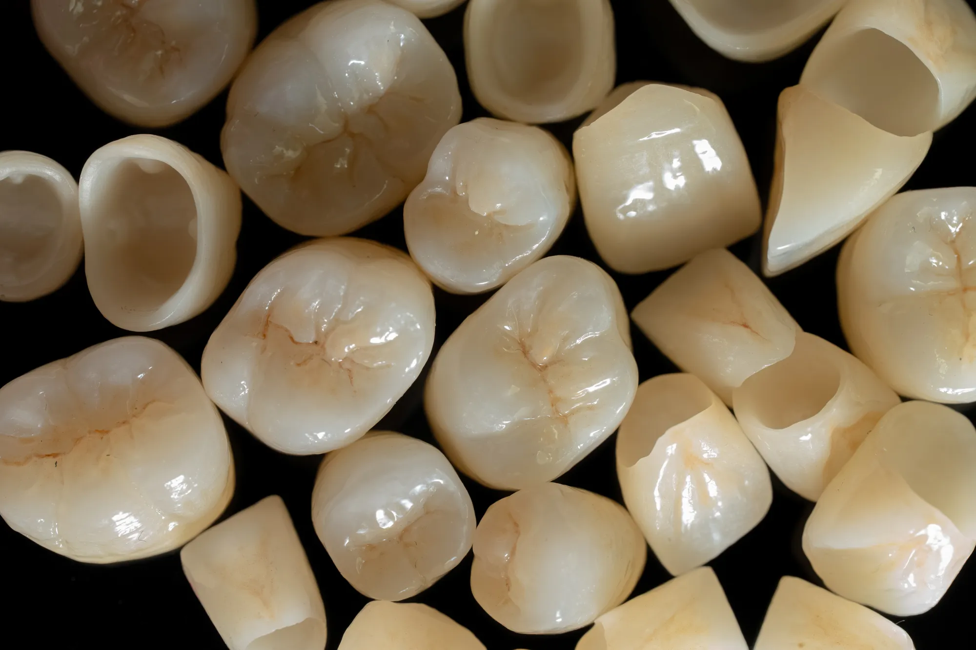 Zirconia Crowns — DA'AT Dental Lab