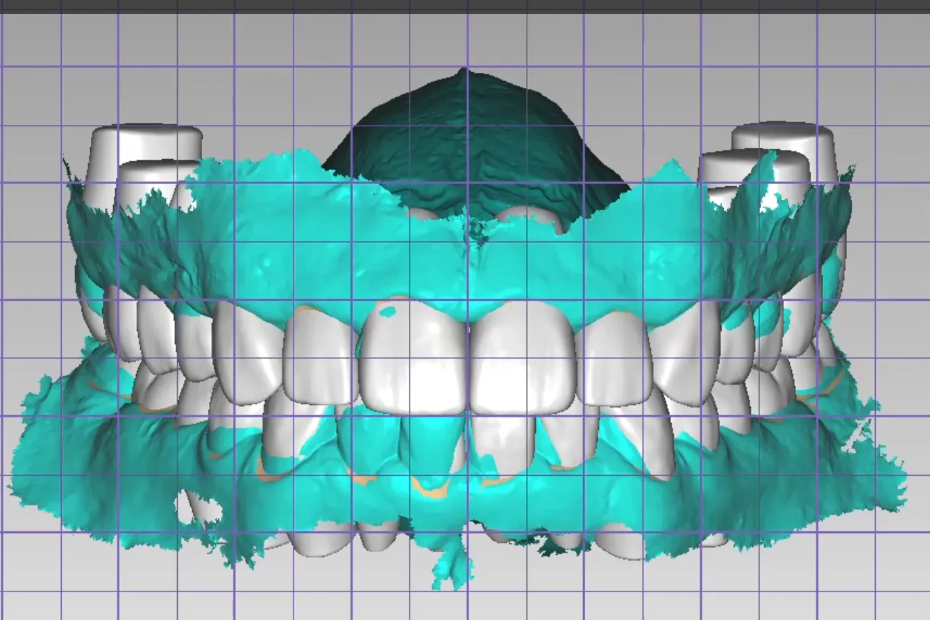 Digital Smile Design — DA'AT Dental Lab