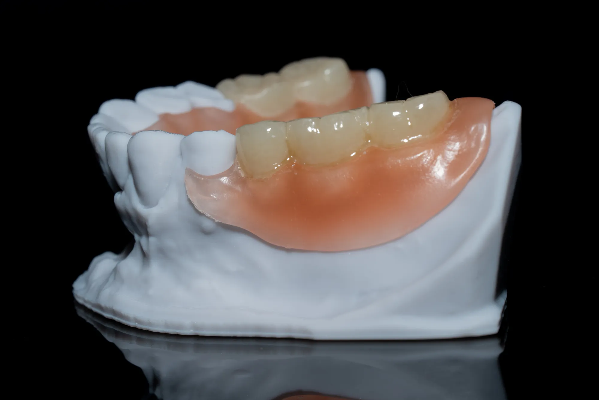 Flexible Dentures — DA'AT Dental Lab