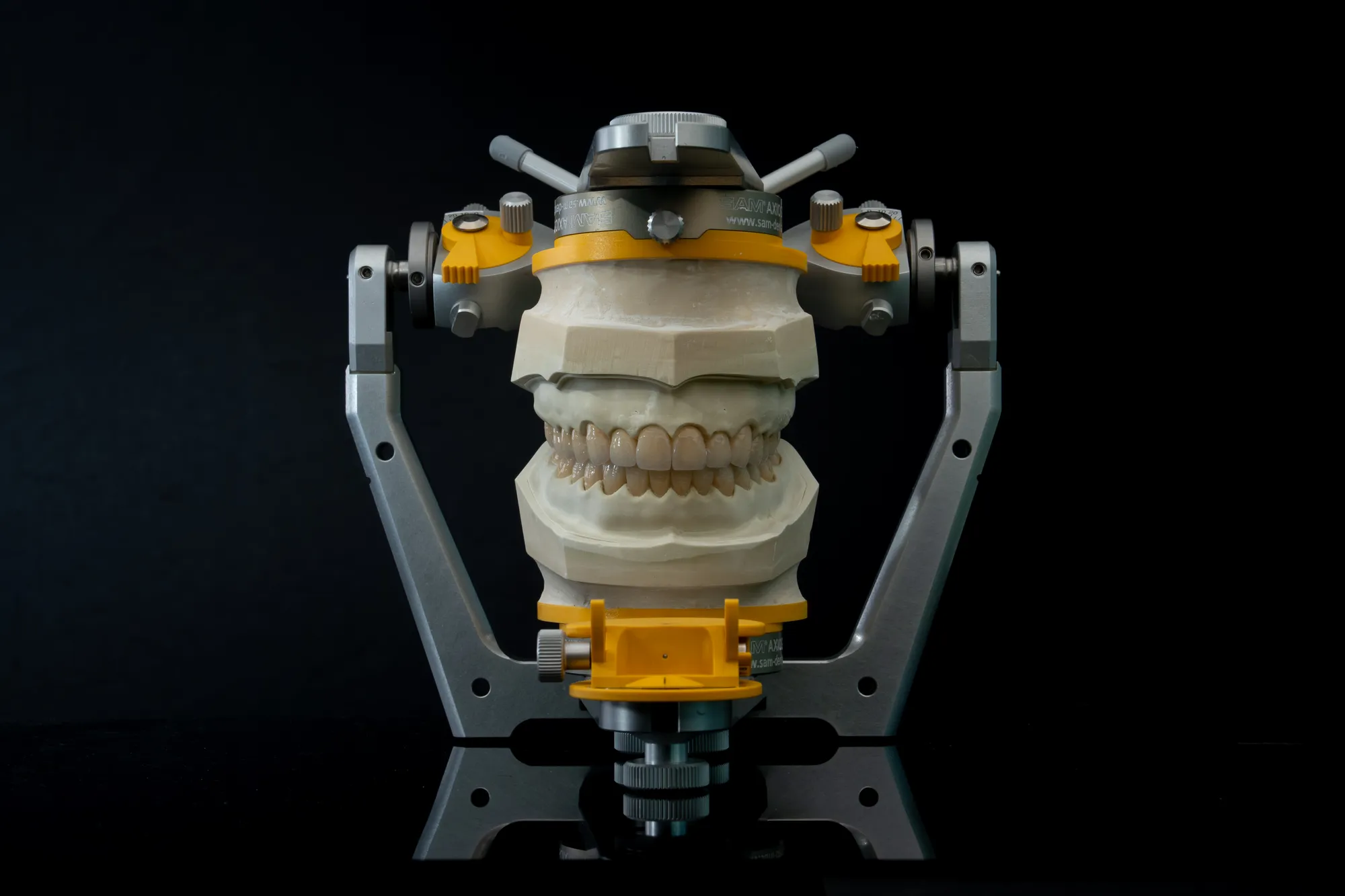 Full Mouth Restoration