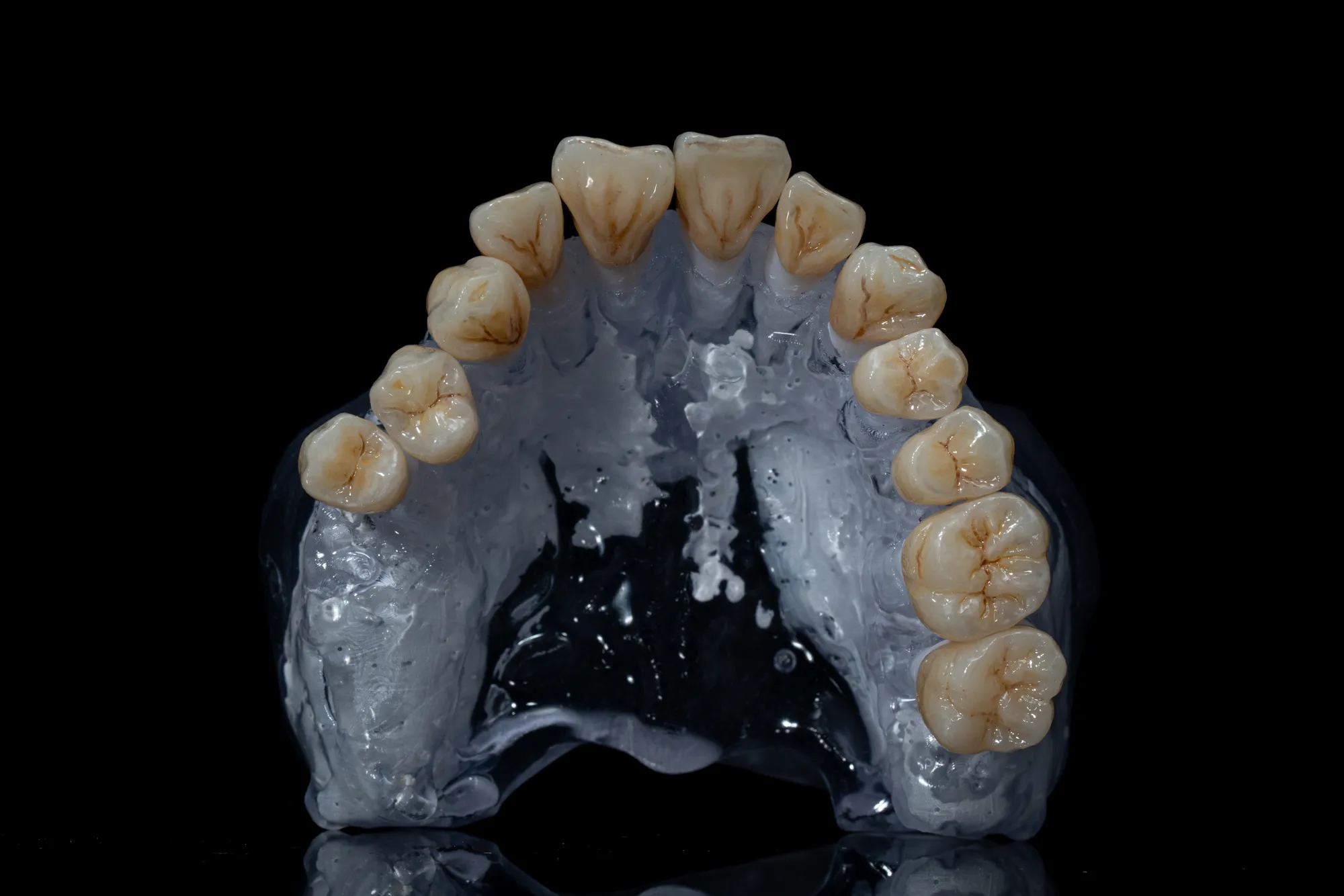 Full Mouth Restoration case 3 — DA'AT Dental Lab