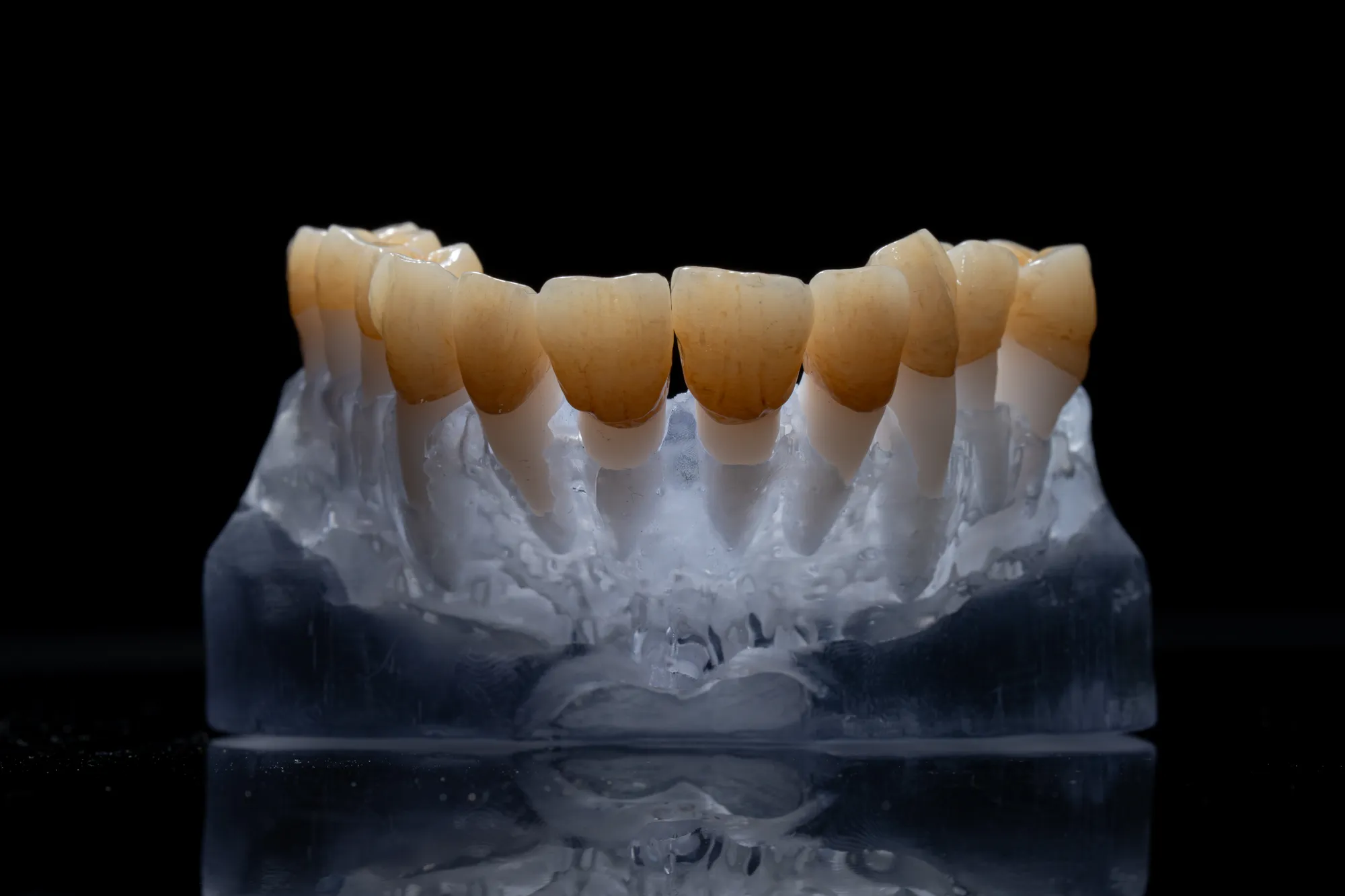 Zirconia Crowns case 5 — DA'AT Dental Lab