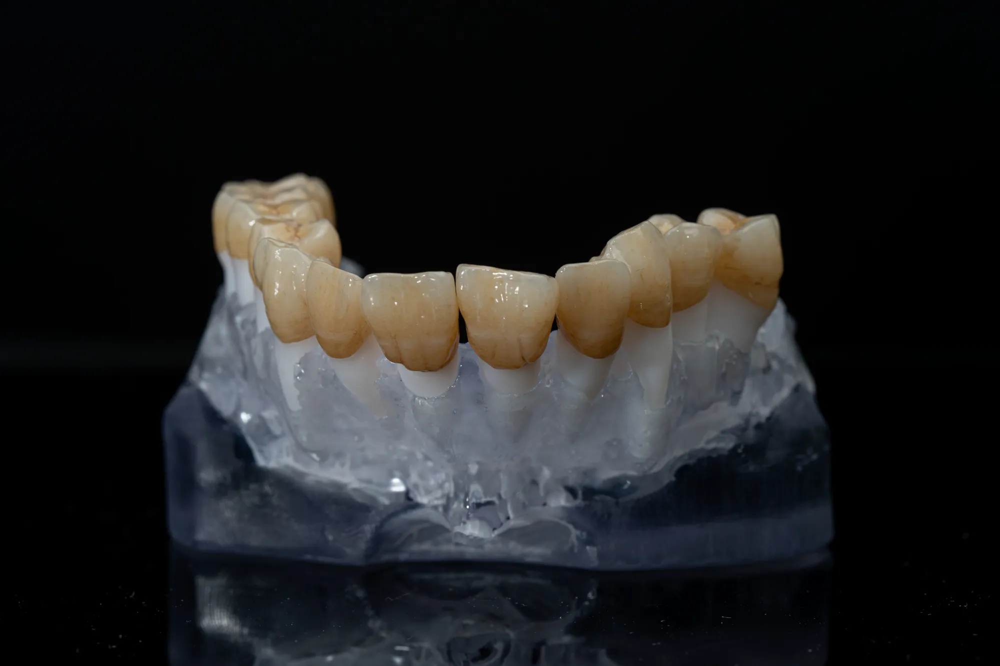 Full Mouth Restoration — DA'AT Dental Lab