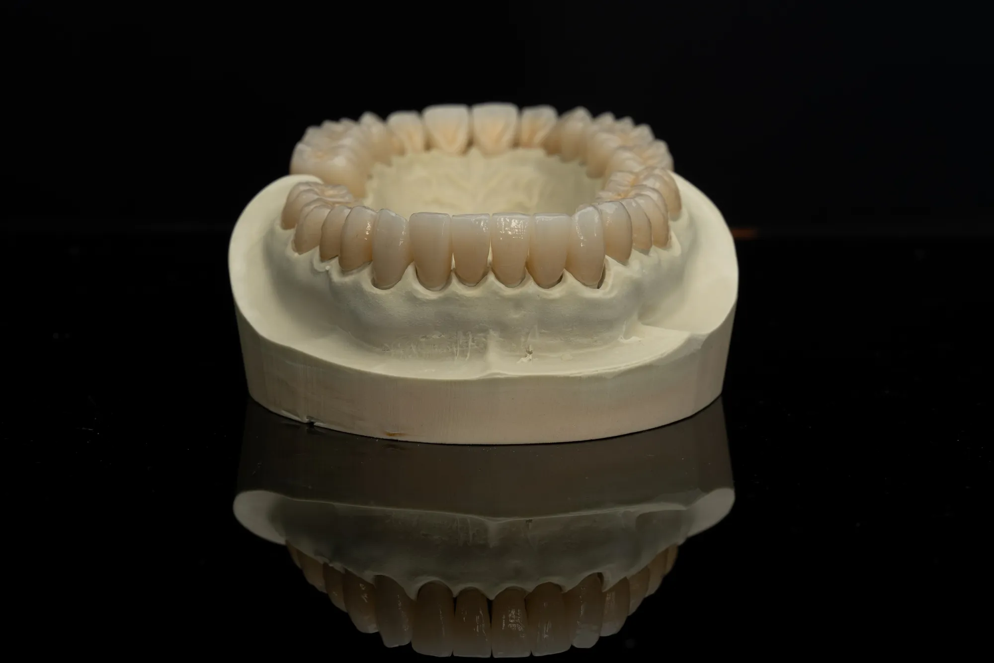 Full Mouth Restoration case 5 — DA'AT Dental Lab