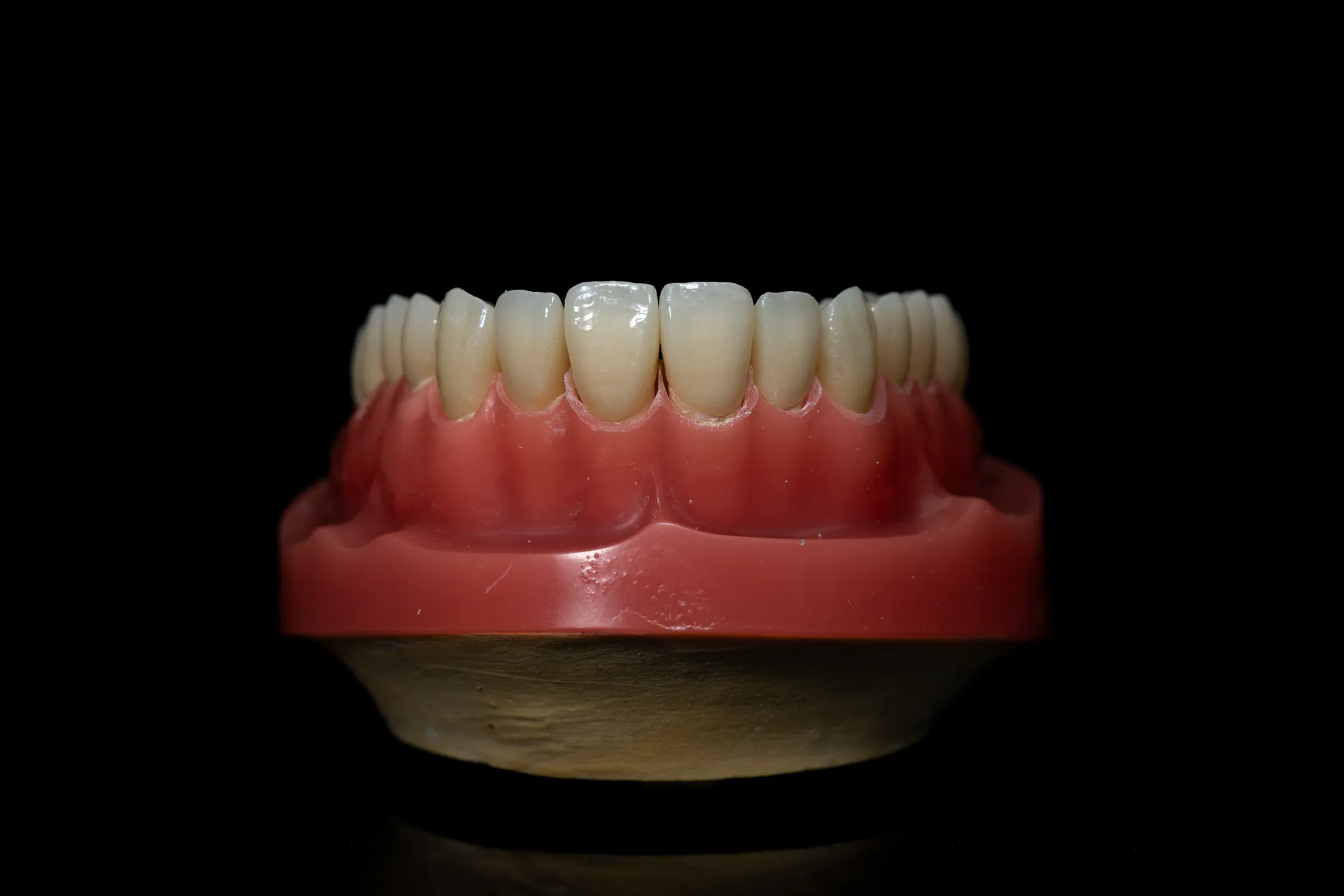 Full Mouth Restoration case 4 — DA'AT Dental Lab