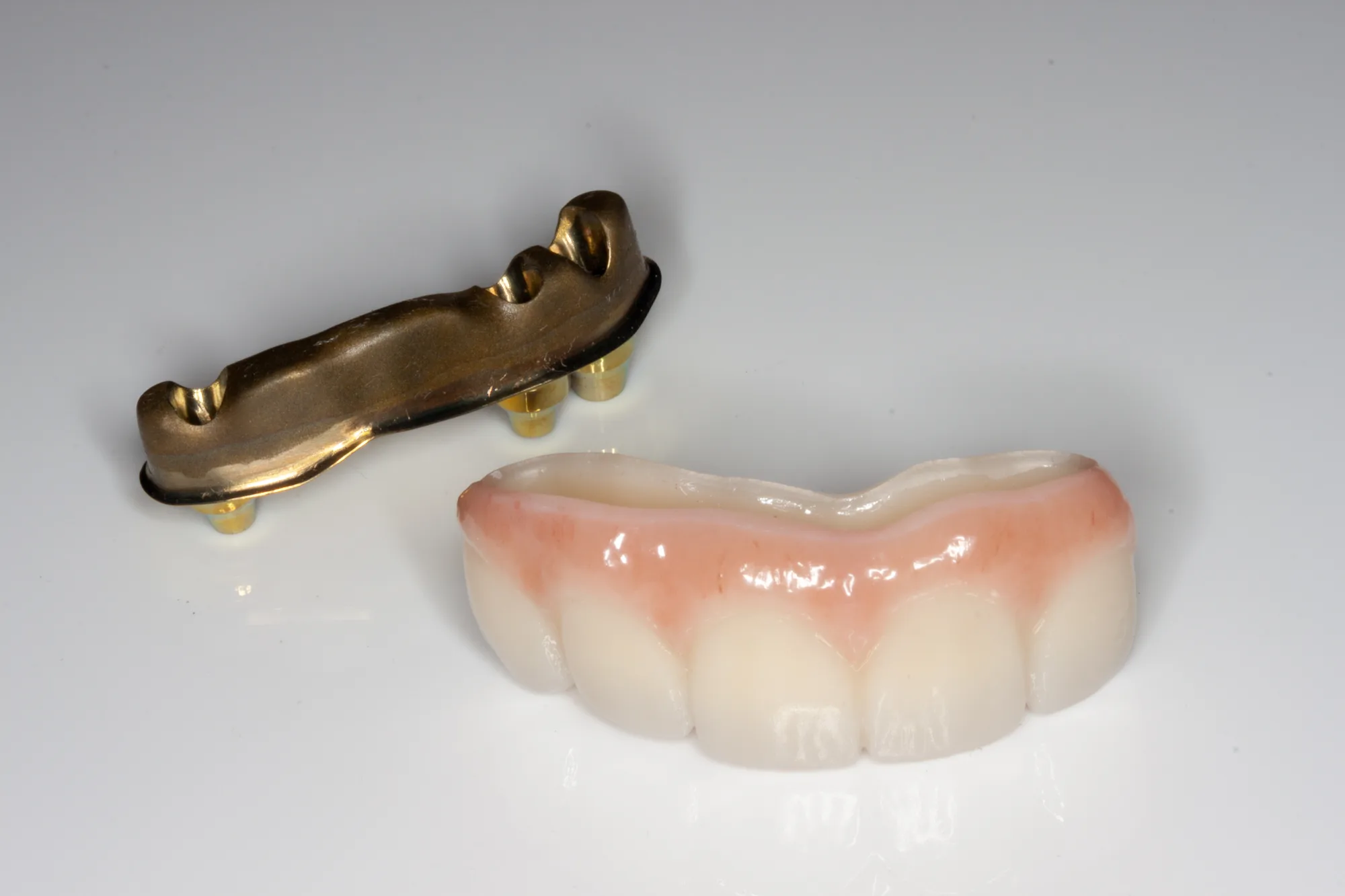 Implant Bridges — DA'AT Dental Lab