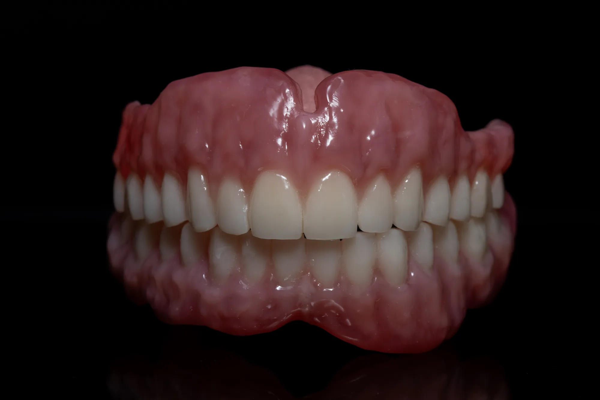 Complete Denture