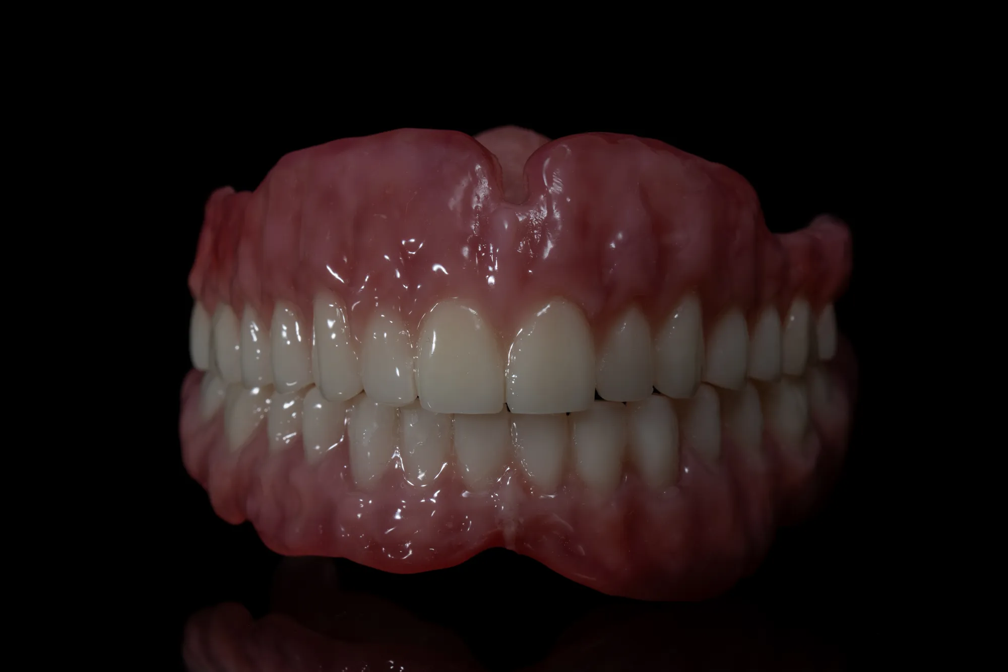 Complete Dentures