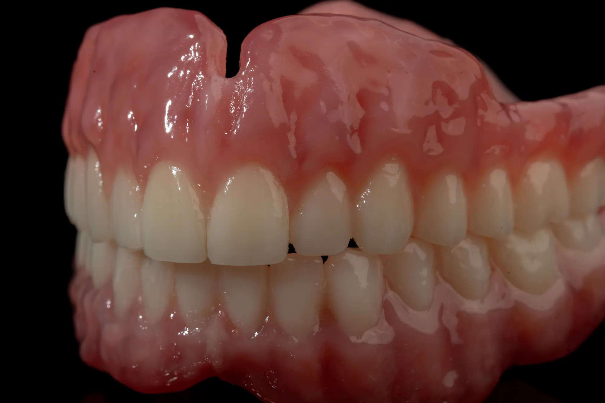 Complete Denture