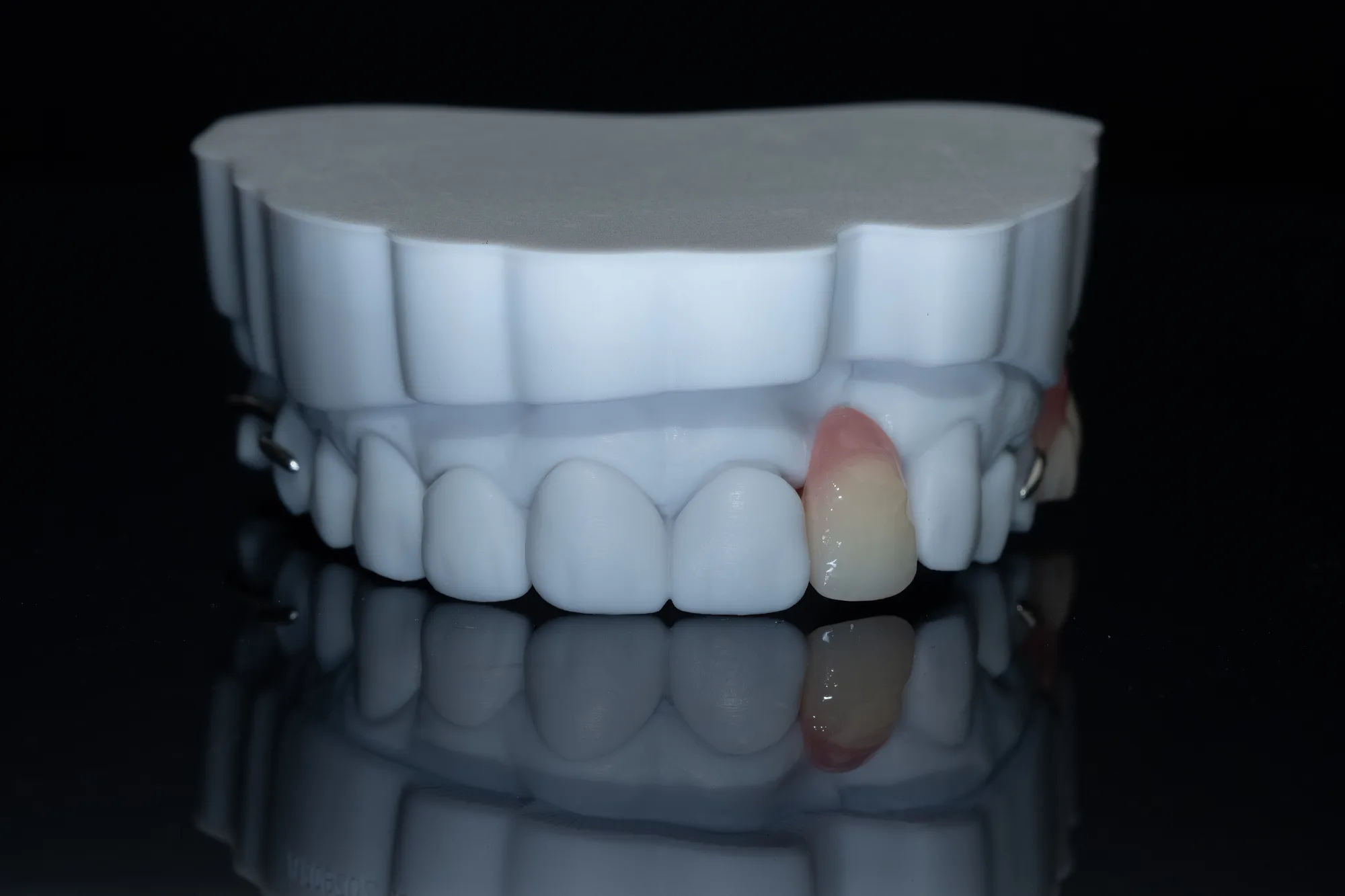 Partial Dentures — DA'AT Dental Lab