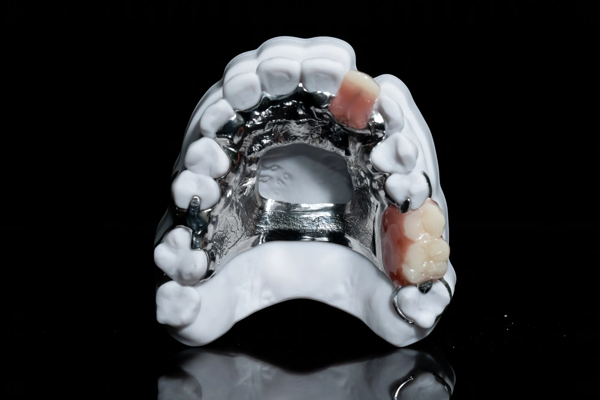 Partial Dentures case 3 — DA'AT Dental Lab