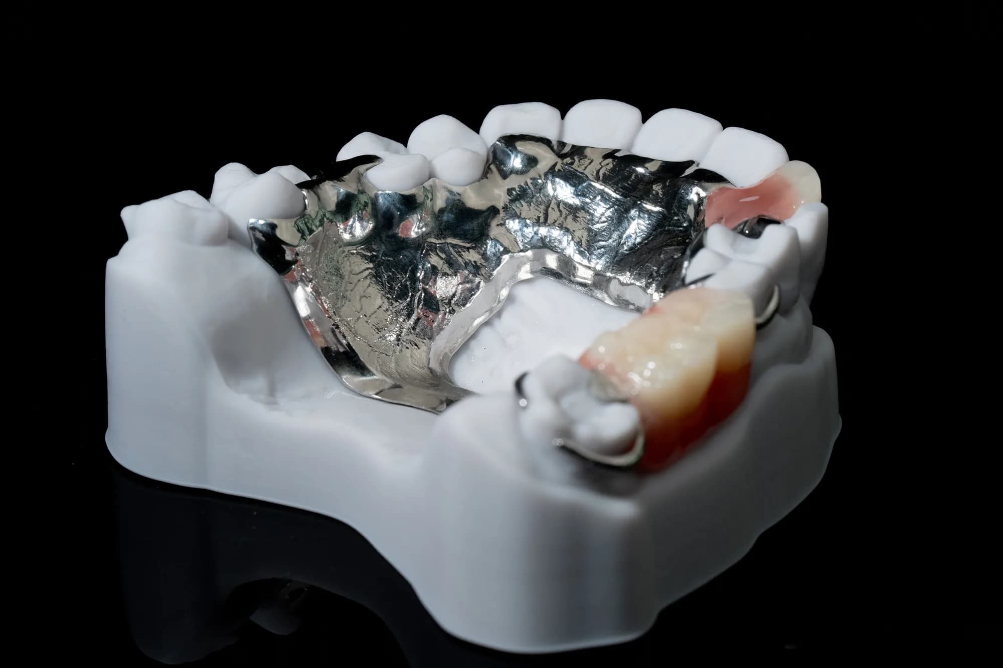 Partial Dentures — DA'AT Dental Lab