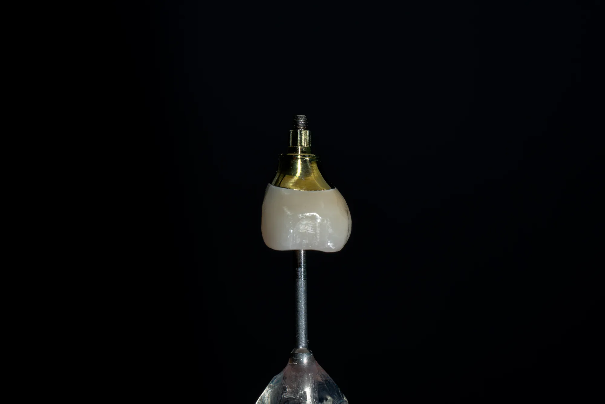 Implant Crowns case 6 — DA'AT Dental Lab
