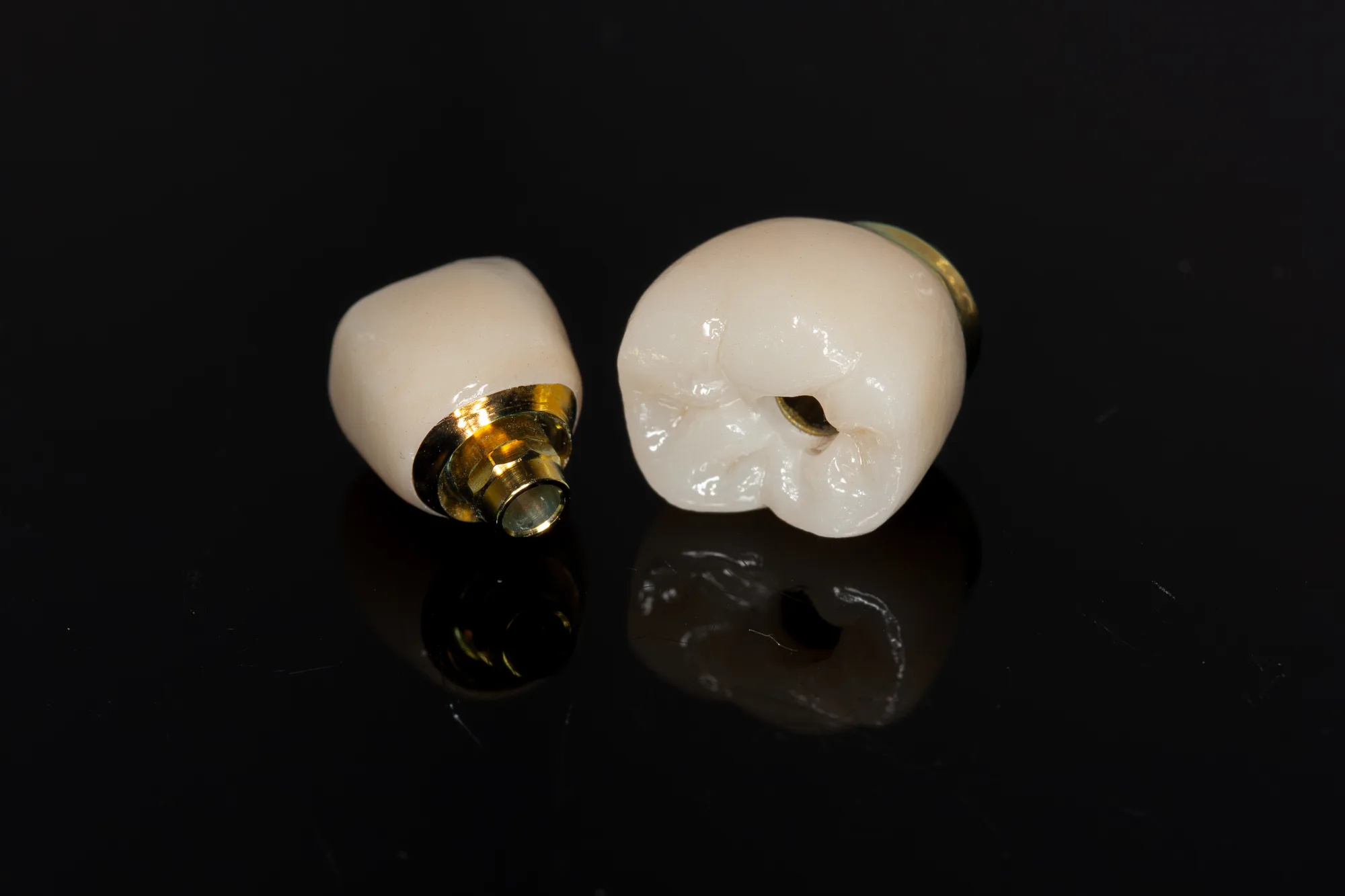 Single Implants
