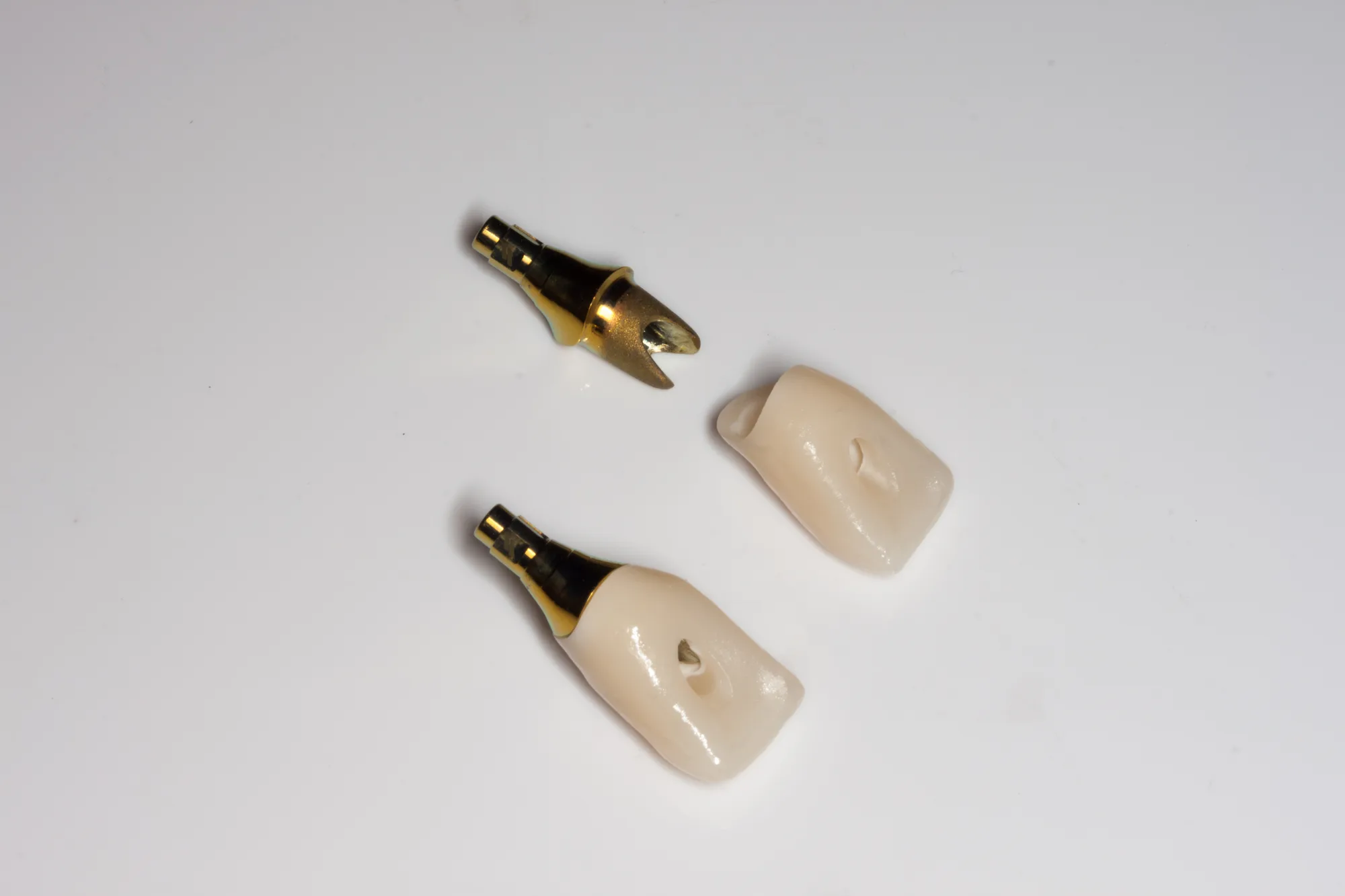 Single Implants