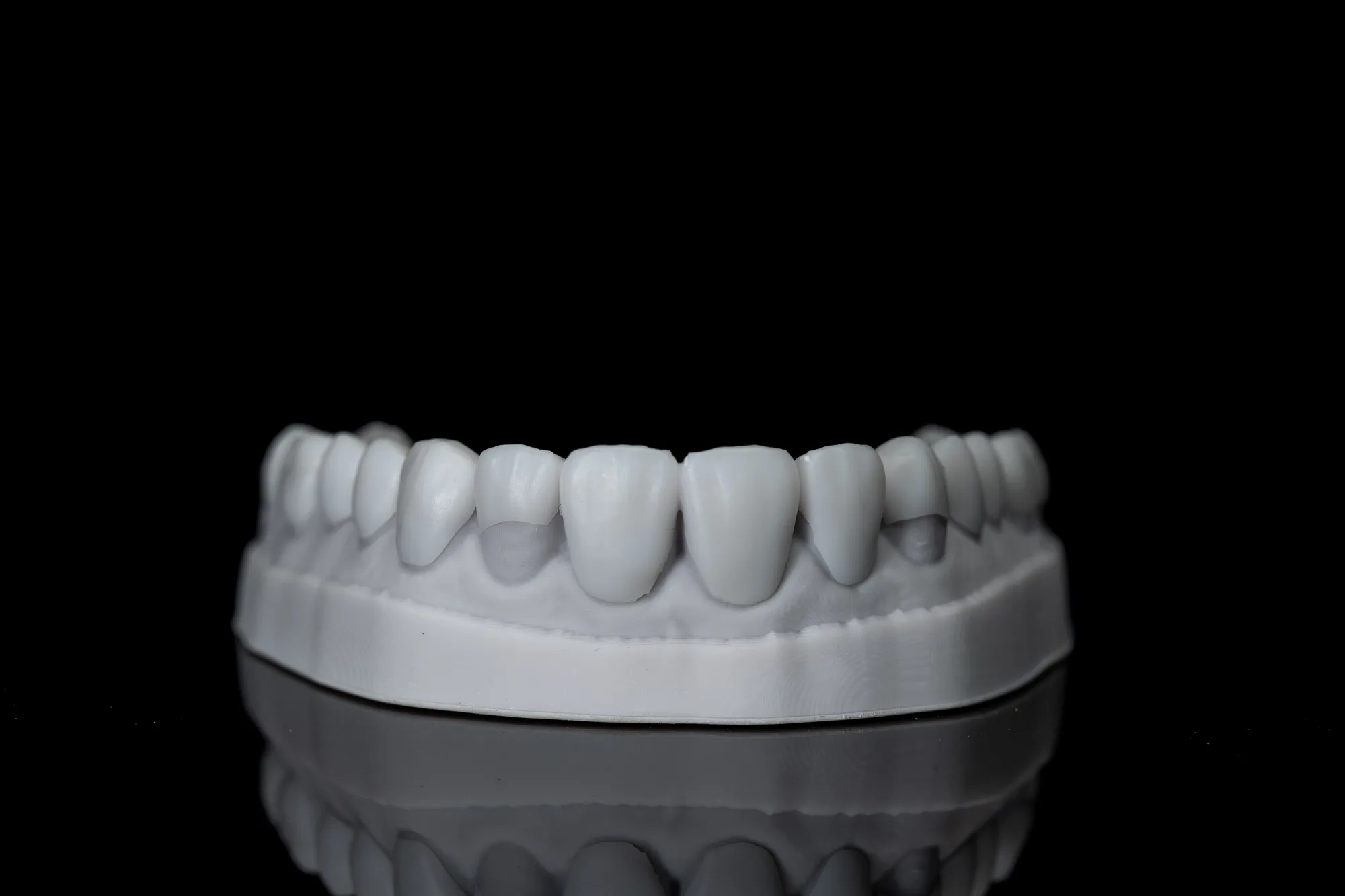 Digital Smile Design — DA'AT Dental Lab