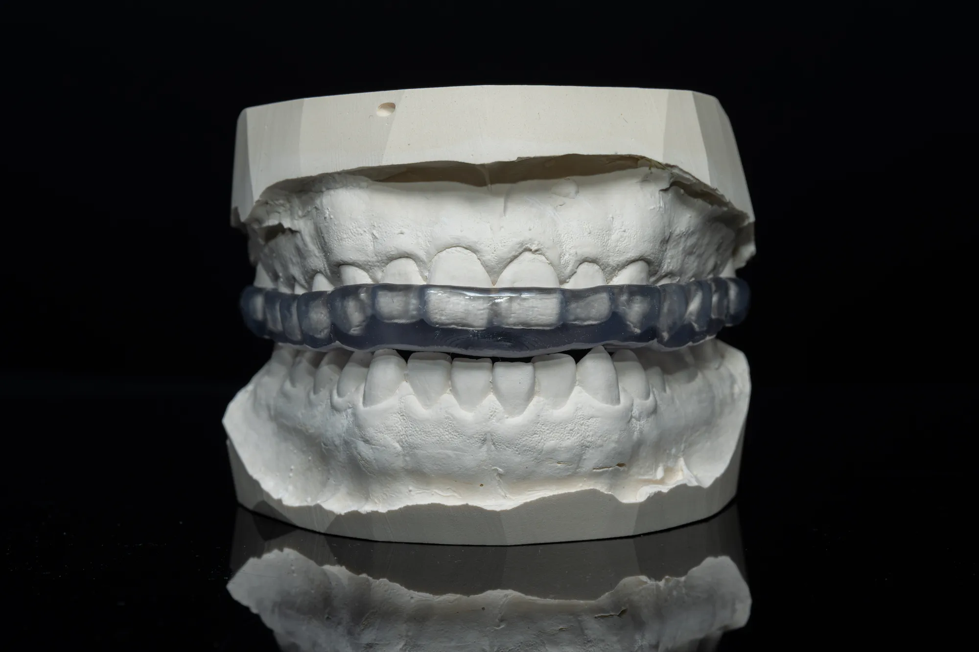 Night Guards — DA'AT Dental Lab