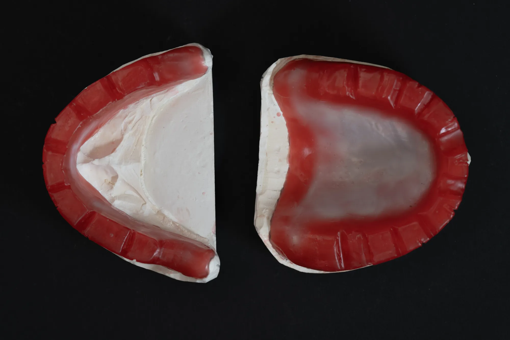 Complete Denture