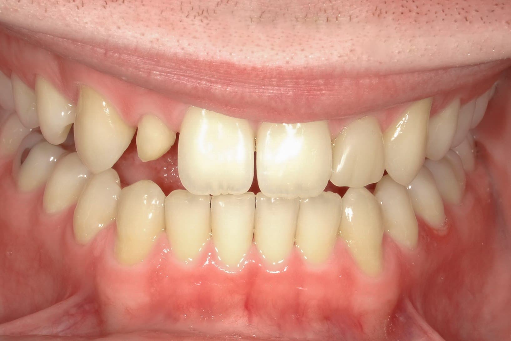 Maryland Bridge before